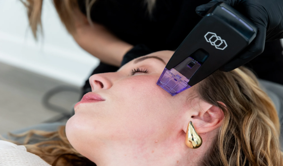 Does Morpheus8 for Wrinkles Really Stimulate Collagen?
