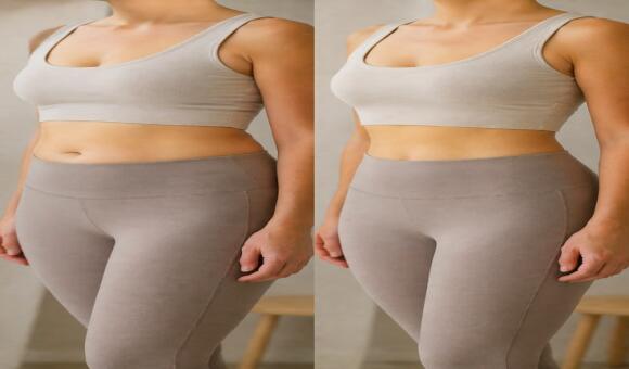 Mommy Makeover Dubai: Redefining Postpartum Wellness Through Targeted Surgery
