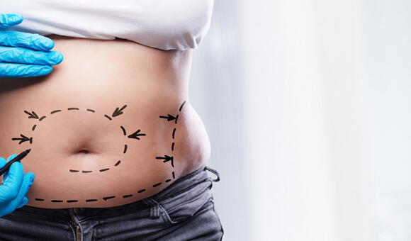 How Much Does a Mommy Makeover Cost in Dubai? Complete Pricing & Procedure Guide